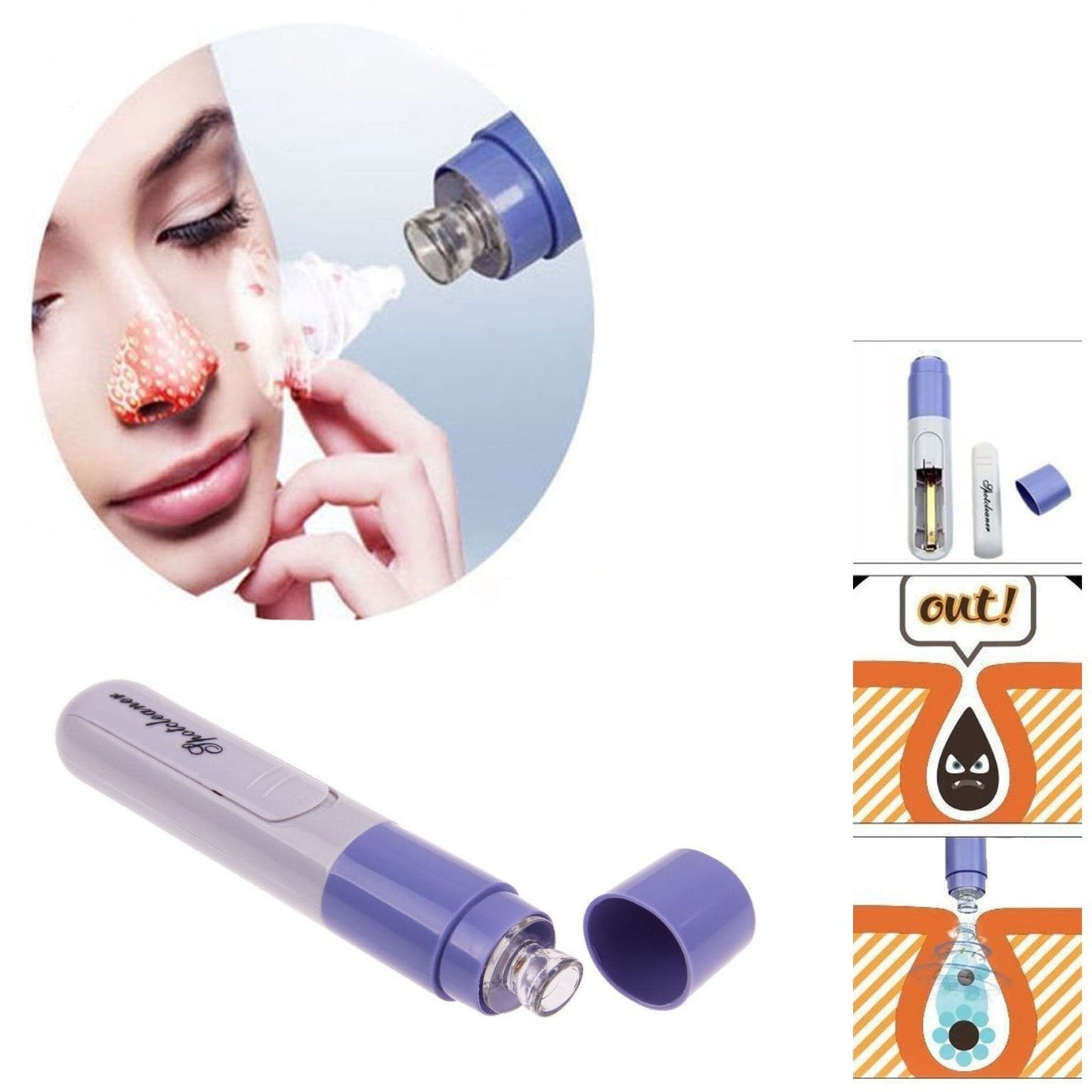 Electric Facial Pore Cleanser Face Blackhead Remover Skin Cleaner Tool 4756 (Parcel Rate)